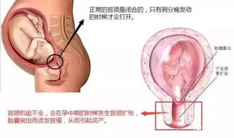 10小时完成22台腹腔镜下子宫宫颈环扎手术,精湛技术助多地患者圆 母亲梦 