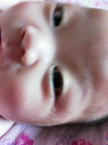四个月宝宝突然一只眼睛老流眼泪(4个月宝宝一只眼睛流眼泪怎么回事)