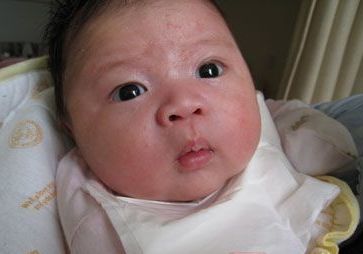 婴儿7个月起湿疹,7个月宝宝湿疹怎么治