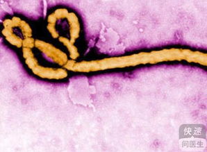 埃博拉病毒传播途径 埃博拉病的传播途径是什么