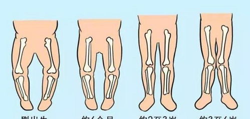 三种行为可能会影响宝宝腿型发育,家长不当回事,宝宝会遭罪
