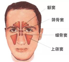 小鼻炎大危害 盘点鼻炎对各人群的危害