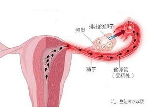 为什么做完输卵管通水后仍未怀孕 