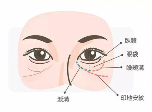 皱纹也许会迟到,但永远不会缺席