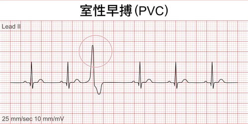 心跳突然很快,当心是这个问题