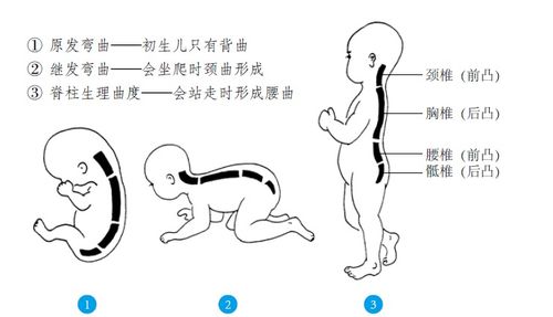 如何恢复腰骶椎的生理曲度？