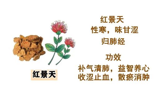 大白话说中医第一百六十九期 肺热小方四味药,相互配合有奇效