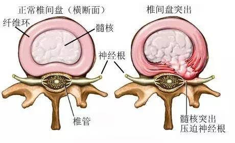 拿什么拯救你 出租司机的颈椎 腰椎