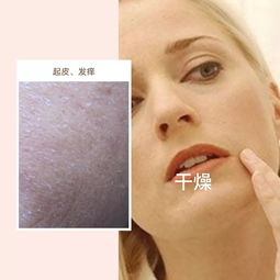 皮肤养护 如何保护身体皮肤？ 