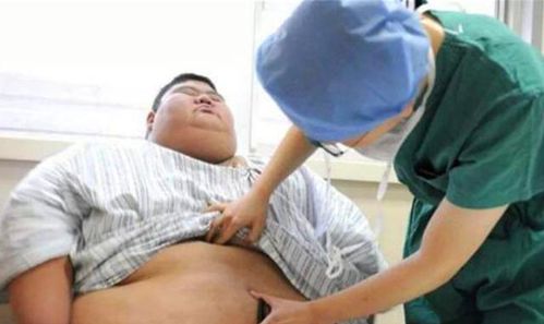 中国第一胖 王浩楠 一年甩掉363斤,减肥之后如愿抱得美人归 