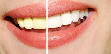 为什么说用嚼碎的生花生米刷牙可以美白牙齿真的吗