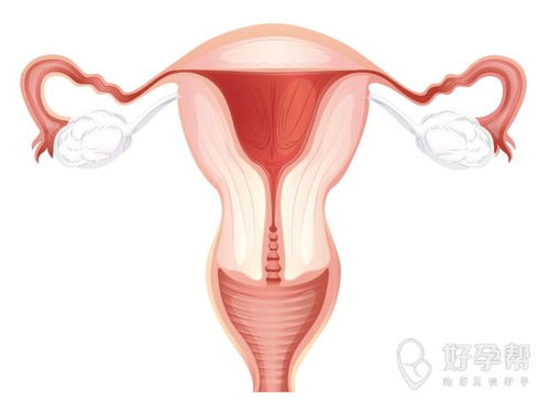 宫内膜增厚怎么办 子宫内膜增厚怎么办