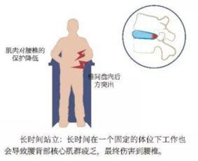 第 3 问 哪些因素容易导致腰椎间盘突出 