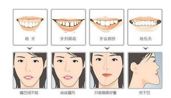 牙齿畸形？牙齿畸形的常见类型