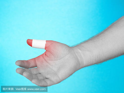 手指上的粘合绷带 Adhesive bandage on finger tip. photo 