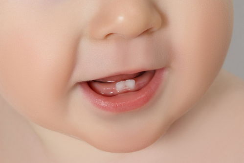 宝宝长牙的异常症状有哪些