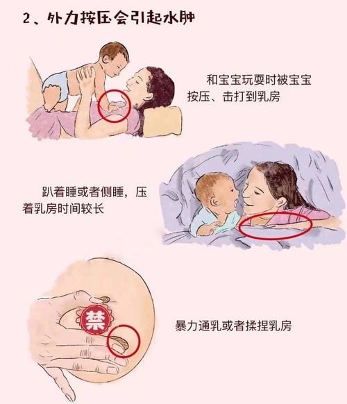 世界母乳喂养周 哺乳期乳房痛怎么办 水肿篇