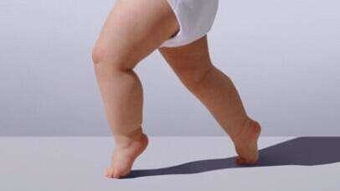 看看宝宝走路的情况,宝宝是否有外八字,内八字,x型腿,o型腿的情况.