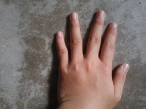 我是一个女生可是手指很短很粗指甲也是很小怎么办 