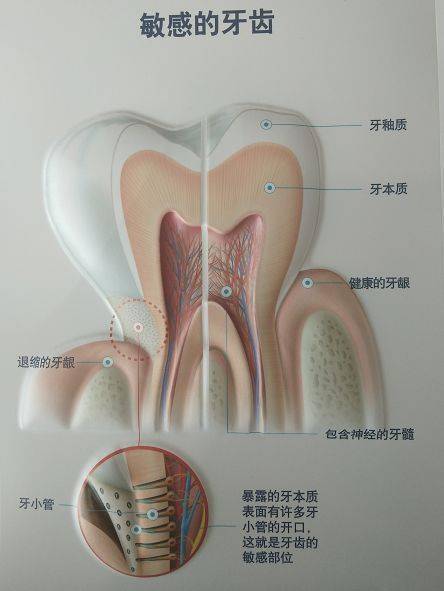 为什么 非要 推荐 你 洗牙