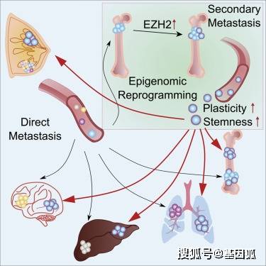 突破,科学家发现癌症骨转移新机制