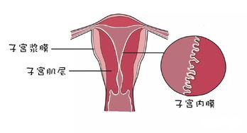 子宫内膜薄如何才能进行试管胚胎移植？