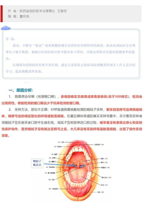 专家解读丨为什么 新冠 检测多次阴性后转阳 是否 恶心 很关键