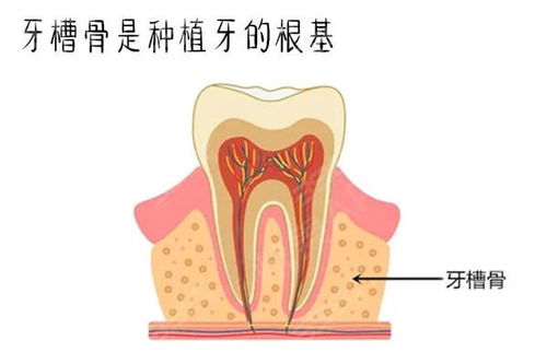 良心医生不建议种植牙的缘由 种植牙虽好但也有风险哦