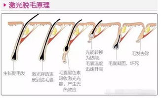 体毛多的女生应该怎么治疗