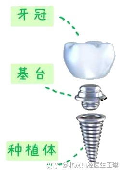 种好的牙牙冠可以更换吗 