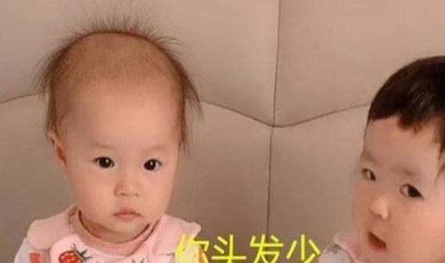 同样是新生儿,发量对比很 悬殊 ,给宝宝剃胎毛会让发量变多吗