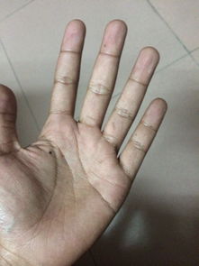 看看我的掌纹命运怎么样 男22岁 两手合起来有六个罗,左手中指和无名指各一个 2个 右手 食指, 