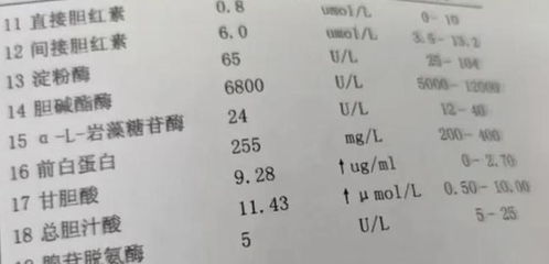 体检报告单中 谷丙转氨酶和谷氨酰转氨酶偏高是怎么回事