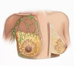 纤维瘤是什么？乳腺纤维瘤是什么症状