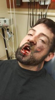 警惕 男子吸烟时突然大爆炸,7颗牙被炸掉 惹祸的竟是它 