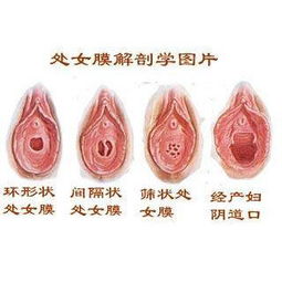 性刺激下，处女膜变化全过程（多图）