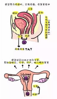 为什么女方有炎症时不能同房 