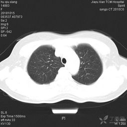 患者,女,54岁,因左侧背部疼痛来诊 影像医学和核医学讨论版 