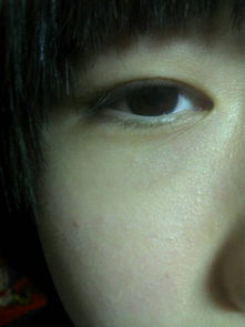 我以前一直以为自己是单眼皮,但是最近我看见上眼皮有点点划痕一样的双眼皮,还是内双,先是右眼,后来左 