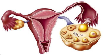 女人怎样保养卵巢？女人卵巢怎样保养