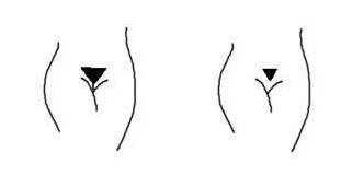 多图展示：女人阴毛的12种形状