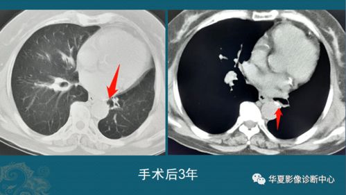 辟谣 明明知道癌症治不好,为什么医院还要治呢