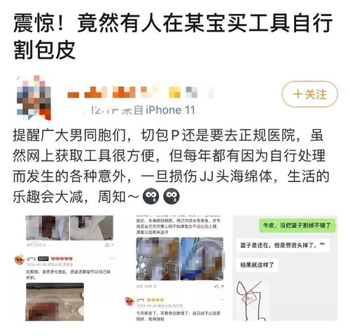 淘宝买自助 割包皮 工具包, 命根子 表示我怕是要废了