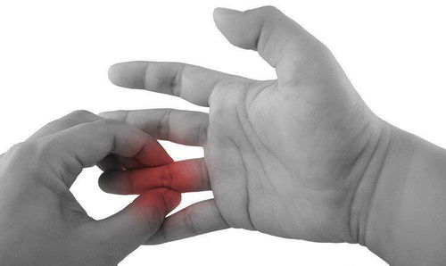 为何掰手指会 咔咔 响 到底能不能掰 骨科医生给出几个说法
