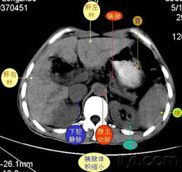 腹部知识