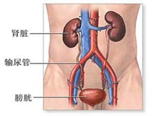 复杂性尿路感染的病因 治疗 症状检查 诊断 预防 医院 求医网 