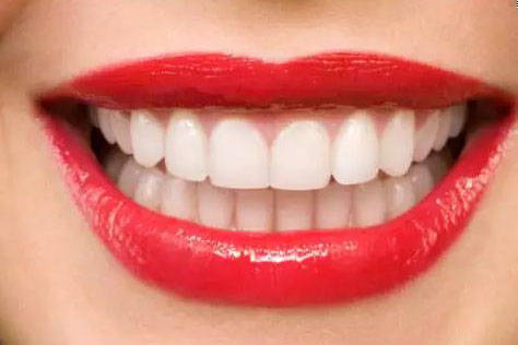 北京种植牙修复缺失的门牙一般价格是多少 牙齿价格种植费用详解
