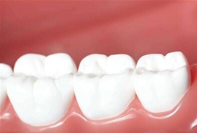 做冷光美白牙齿有什么危害吗 
