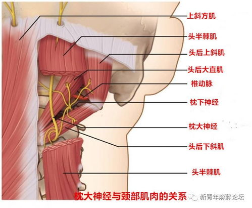 手把手教你超声引导下枕大神经阻滞 