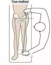 长短腿怎么矫正长短腿的危害-图1